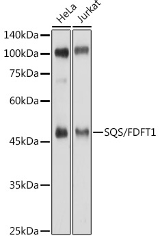 SQS/FDFT1 Rabbit Polyclonal Antibody