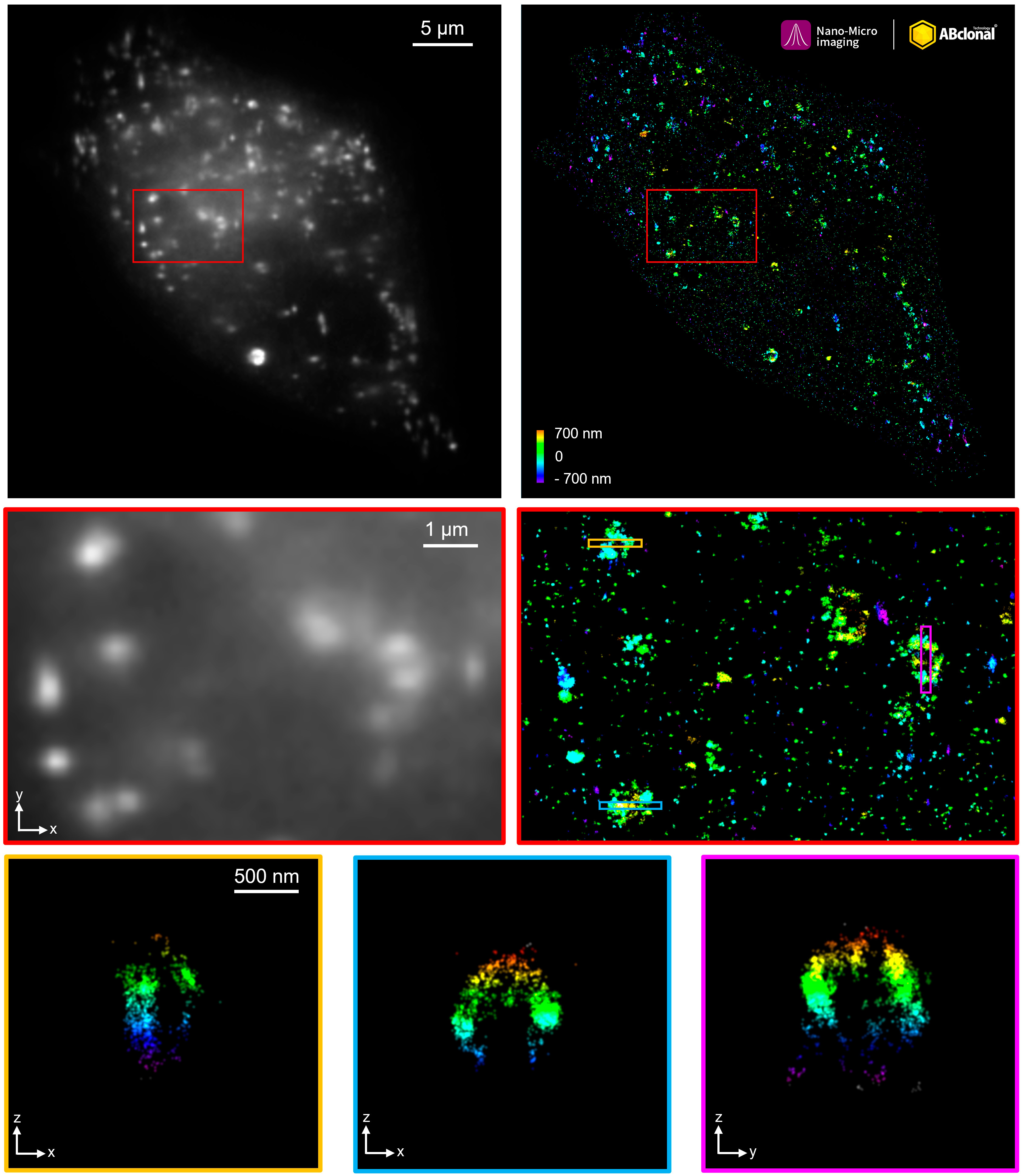 SQSTM1/p62 Rabbit Monoclonal Antibody