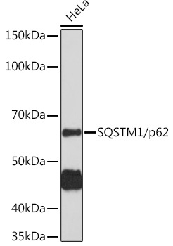 SQSTM1/p62 Rabbit Polyclonal Antibody