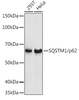 SQSTM1/p62 Rabbit Polyclonal Antibody