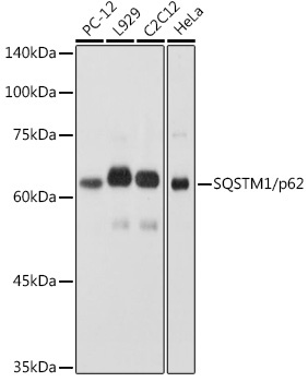SQSTM1/p62 Rabbit Polyclonal Antibody