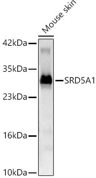 SRD5A1 Rabbit Polyclonal Antibody