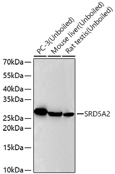 SRD5A2 Rabbit Monoclonal Antibody