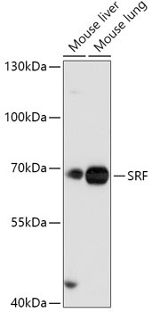 SRF Rabbit Polyclonal Antibody
