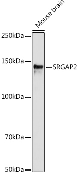 SRGAP2 Rabbit Polyclonal Antibody