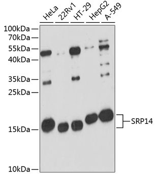 SRP14 Rabbit Polyclonal Antibody