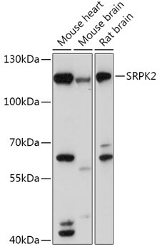 SRPK2 Rabbit Polyclonal Antibody