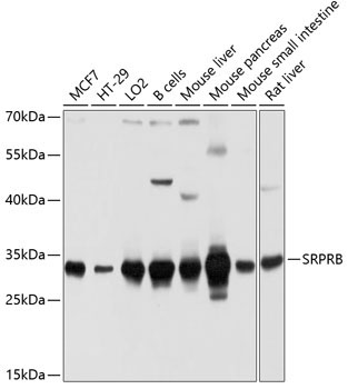 SRPRB Rabbit Polyclonal Antibody