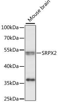 SRPX2 Rabbit Polyclonal Antibody