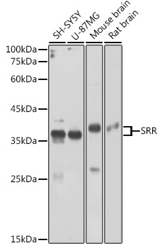 SRR Rabbit Polyclonal Antibody