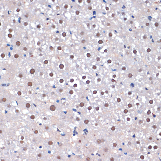 SRRT Rabbit Polyclonal Antibody