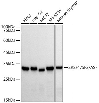 SRSF1/SF2/ASF Rabbit Monoclonal Antibody