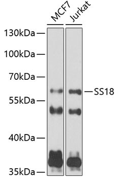 SS18 Rabbit Polyclonal Antibody