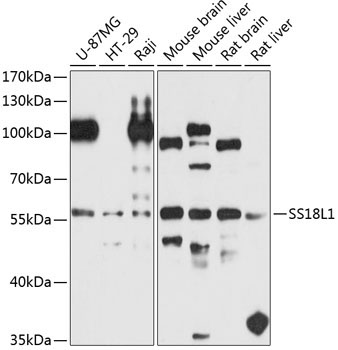 SS18L1 Rabbit Polyclonal Antibody