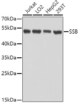 SSB Rabbit Polyclonal Antibody