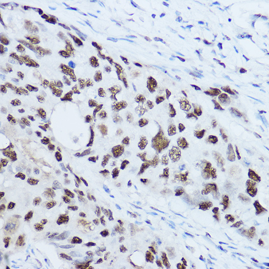SSB Rabbit Polyclonal Antibody - Image 2