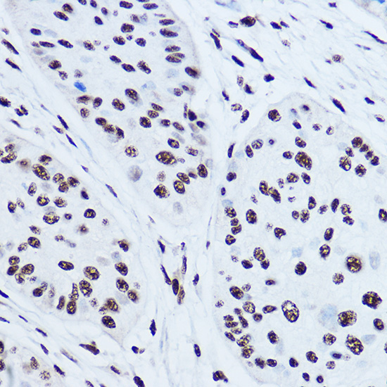 SSB Rabbit Polyclonal Antibody - Image 3