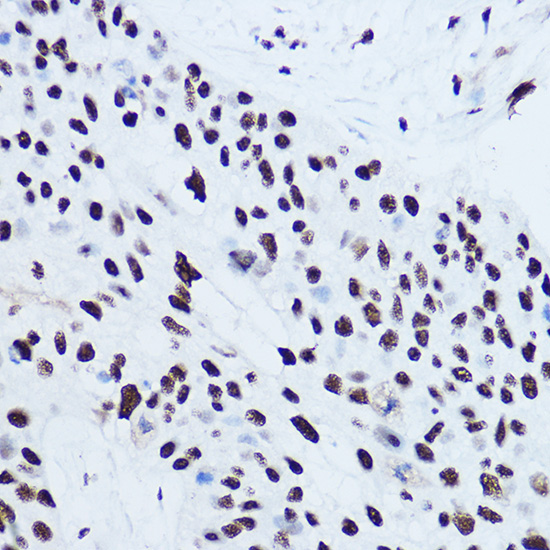 SSB Rabbit Polyclonal Antibody - Image 4