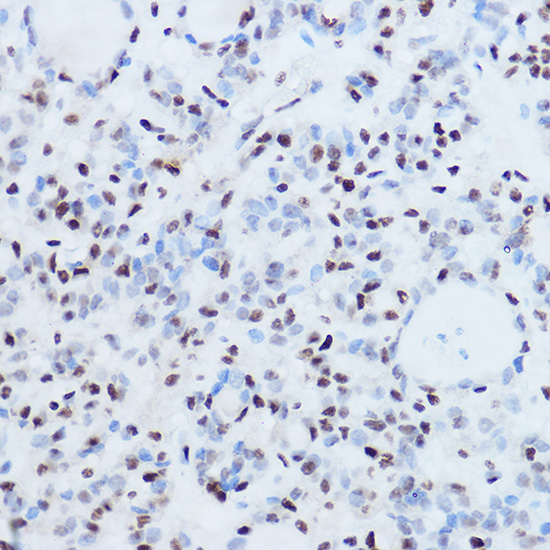 SSB Rabbit Polyclonal Antibody - Image 5