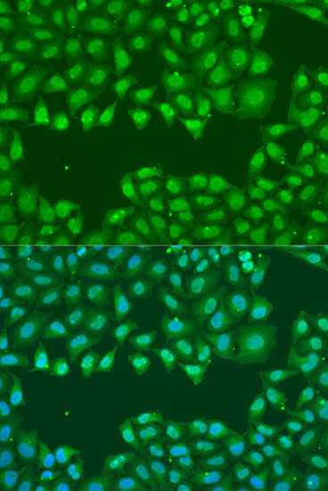 SSB Rabbit Polyclonal Antibody - Image 6