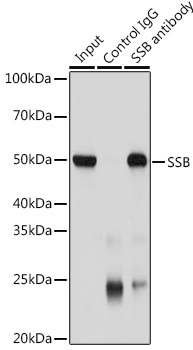 SSB Rabbit Polyclonal Antibody - Image 7
