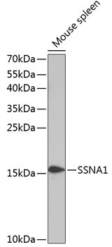 SSNA1 Rabbit Polyclonal Antibody