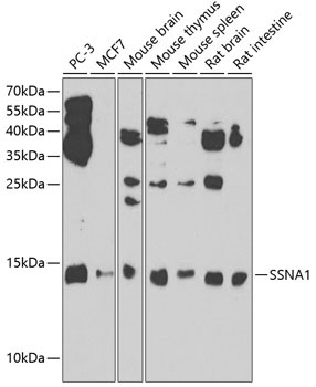 SSNA1 Rabbit Polyclonal Antibody - Image 2