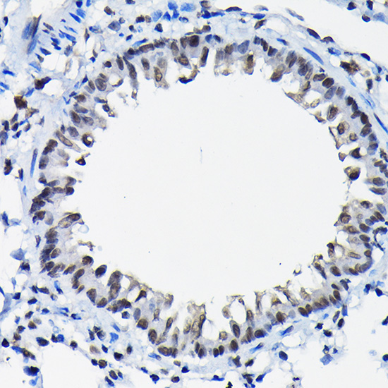 SSNA1 Rabbit Polyclonal Antibody - Image 3