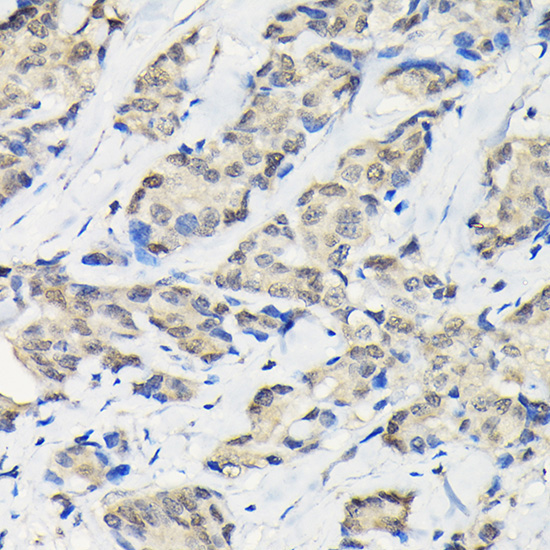 SSNA1 Rabbit Polyclonal Antibody - Image 4