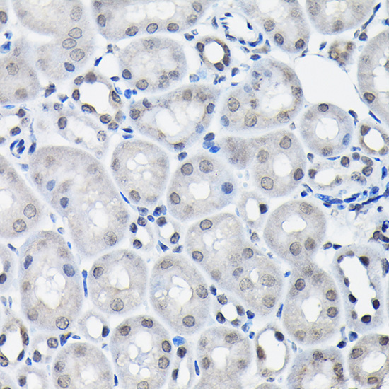 SSNA1 Rabbit Polyclonal Antibody - Image 5