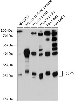 SSPN Rabbit Polyclonal Antibody