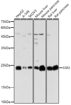 SSR2 Rabbit Polyclonal Antibody