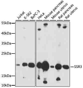 SSR3 Rabbit Polyclonal Antibody