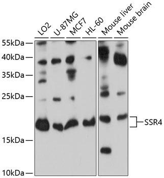 SSR4 Rabbit Polyclonal Antibody