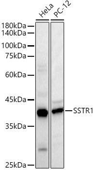 SSTR1 Rabbit Polyclonal Antibody