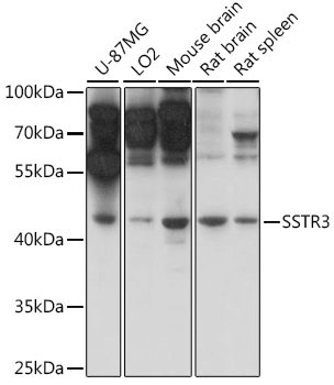 SSTR3 Rabbit Polyclonal Antibody