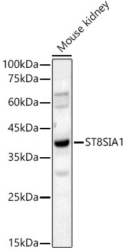 ST8SIA1 Rabbit Polyclonal Antibody