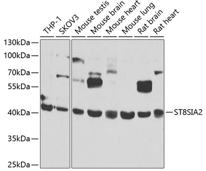 ST8SIA2 Rabbit Polyclonal Antibody