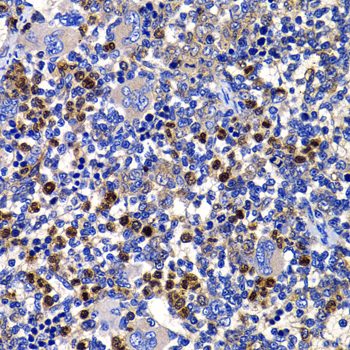 STAMBP Rabbit Polyclonal Antibody - Image 2