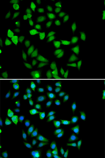 STAMBP Rabbit Polyclonal Antibody - Image 4