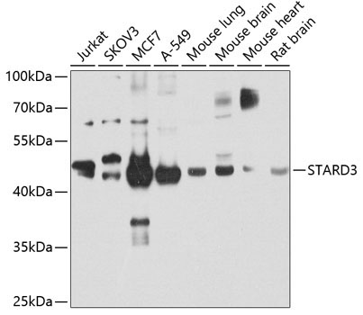 STARD3 Rabbit Polyclonal Antibody