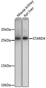 STARD4 Rabbit Polyclonal Antibody