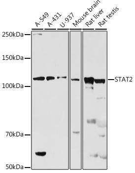 STAT2 Rabbit Polyclonal Antibody