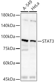 STAT3 Rabbit Polyclonal Antibody