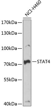 STAT4 Rabbit Polyclonal Antibody