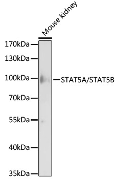STAT5A/STAT5B Rabbit Polyclonal Antibody