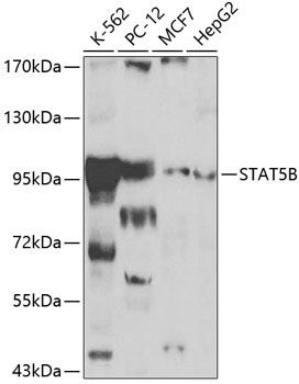STAT5B Rabbit Polyclonal Antibody
