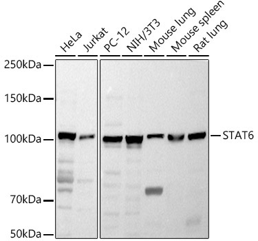 STAT6 Rabbit Polyclonal Antibody