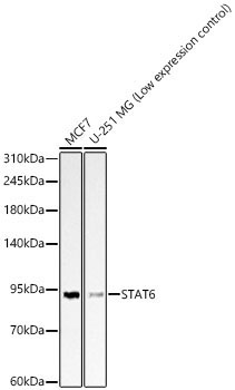 STAT6 Rabbit Polyclonal Antibody