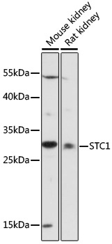 STC1 Rabbit Polyclonal Antibody